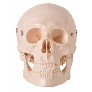 Crânio Humano Com 5 Partes