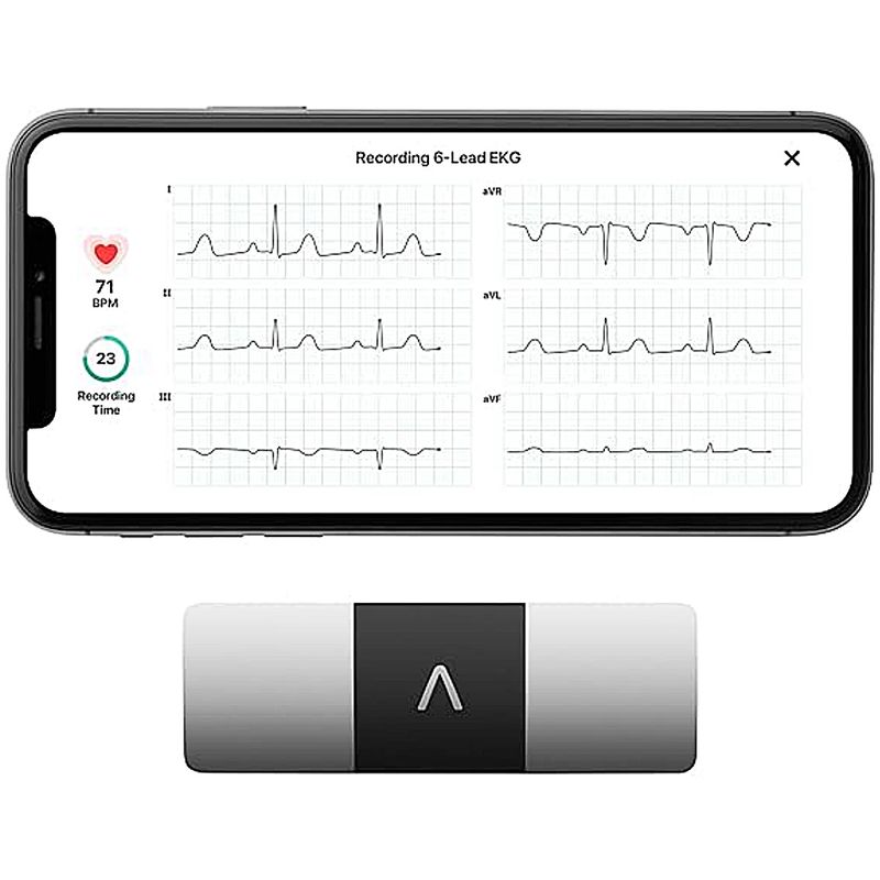 eletrocardiograma-ecg-portatil-omron-kardiamobile-6l-conectividade
