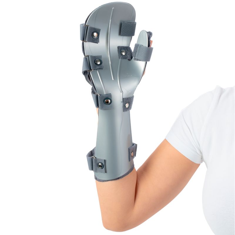 Humanizada mostrando a palma da mão com a tala