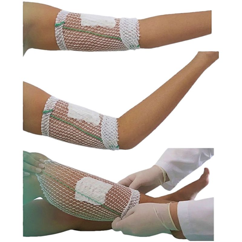 poolfix-rede-tubular-elastica-5-visao-humanizada