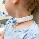 fixador-canula-traqueostomia-infantil-visao-geral
