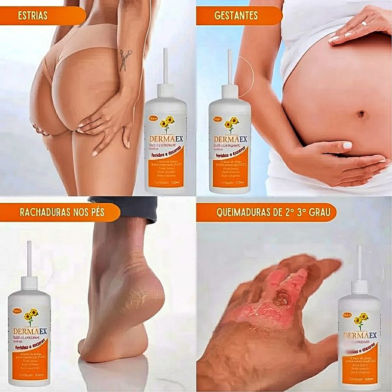oleo-cicatrizante-age-dermaex-200ml-detalhes